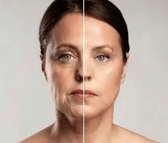 Armonía facial: cuando la precisión devuelve la luz al rostro